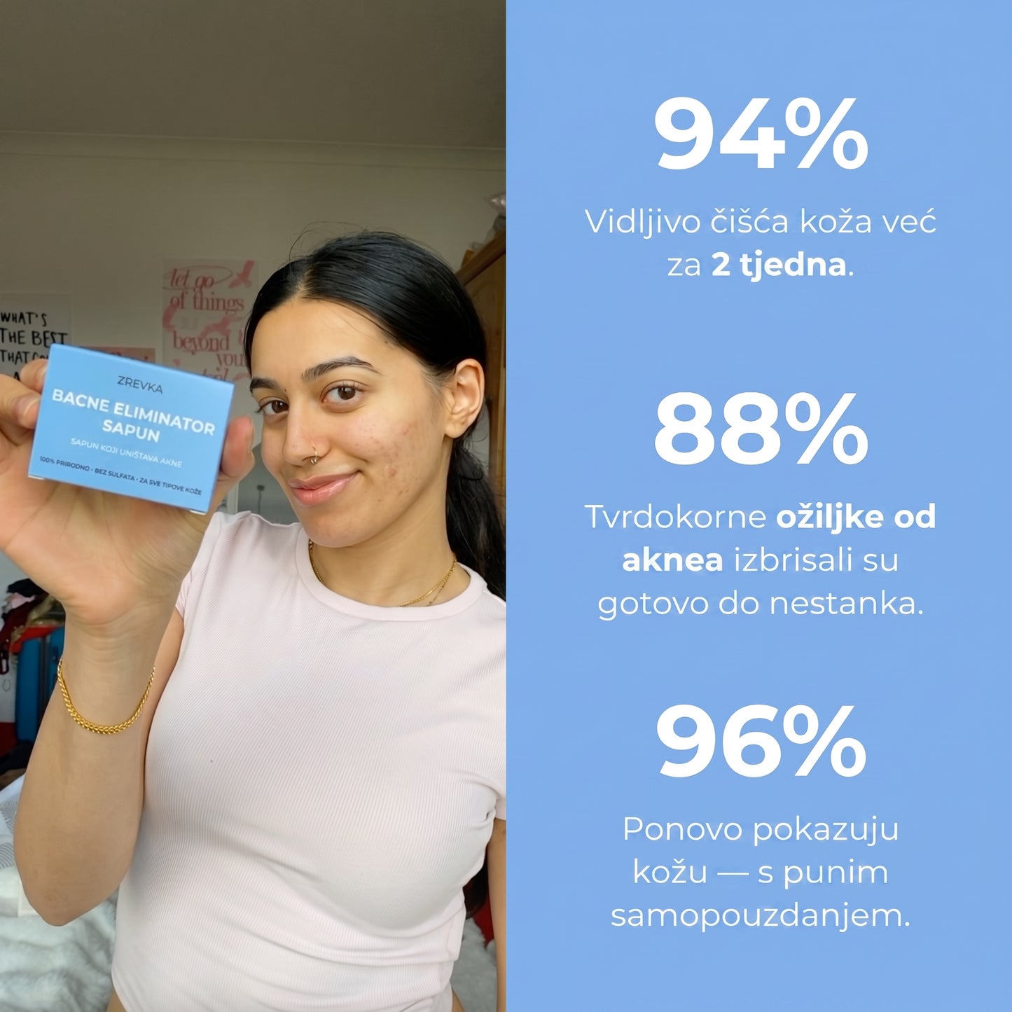 Zrevka - Prirodni sapun protiv akni